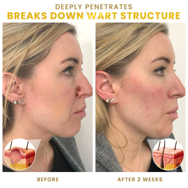 Blusoms™ Lucid WartPro Plus+ Ampoules Essence - Image 5