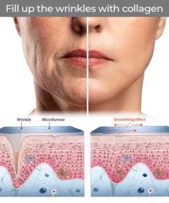 CELLvolution™ Soluble 24k Gold Protein Lifting Thread