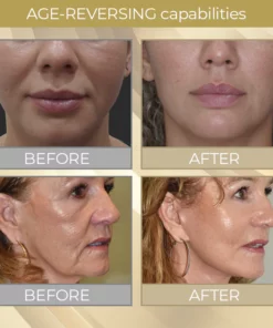 CELLvolution™ Soluble 24k Gold Protein Lifting Thread