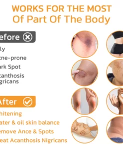 CNDB FAFASKIN Back Spots And Acanthosis Nigricans Cleansing Lotion