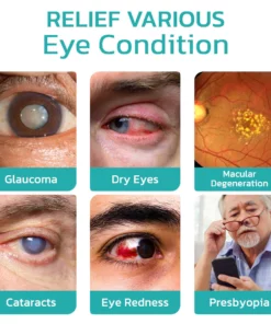 CNDB OphthlaMed Vision Enhance Roller