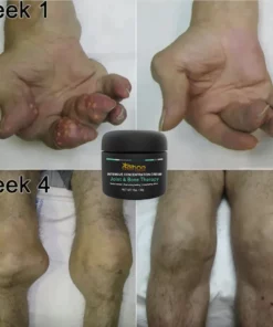 EELHOE™ Joint And Bone Therapy Cream