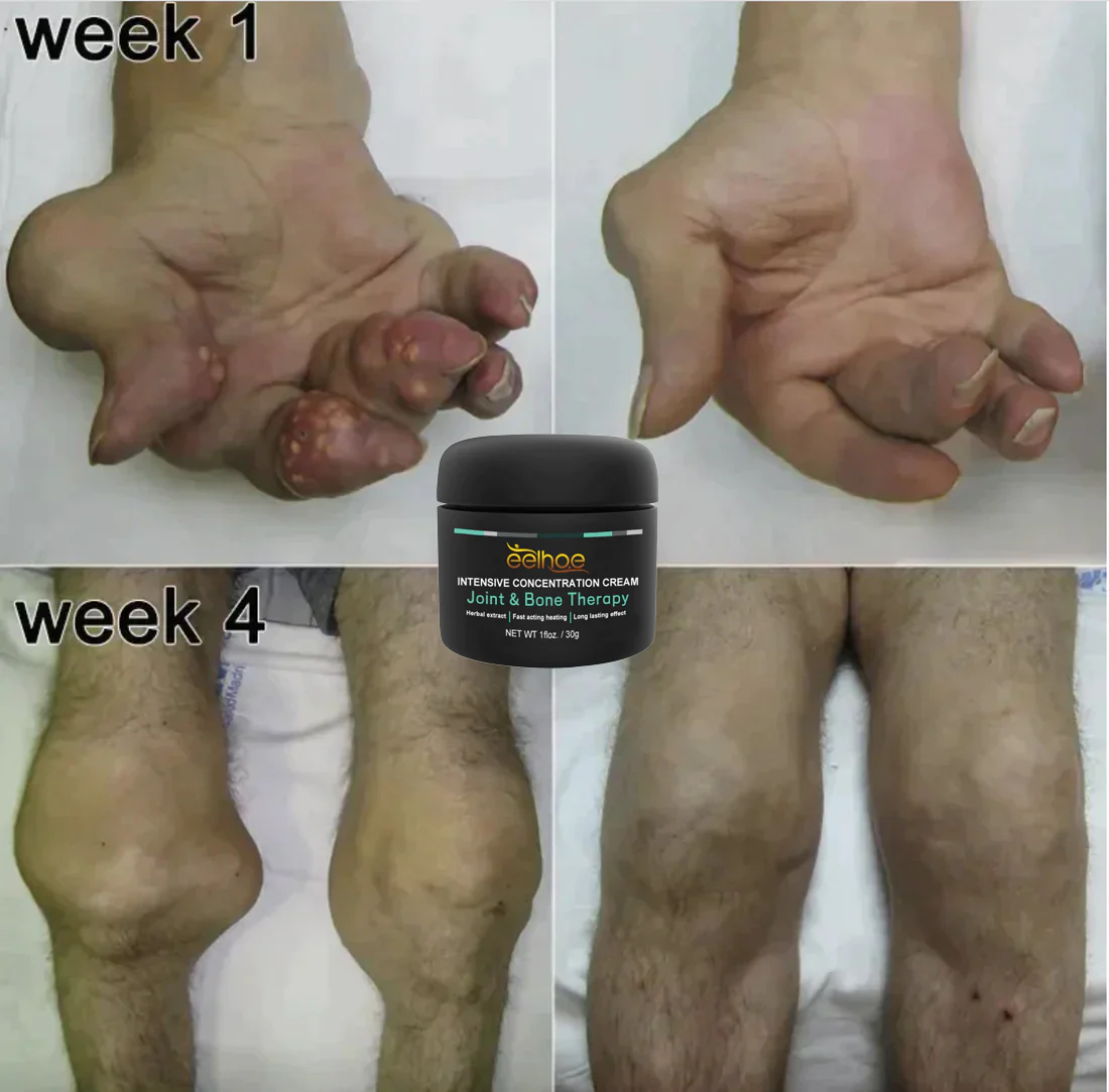 EELHOE™ Joint And Bone Therapy Cream