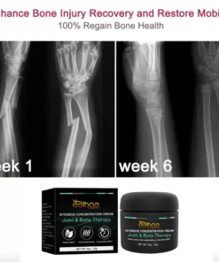 EELHOE™ Joint And Bone Therapy Cream