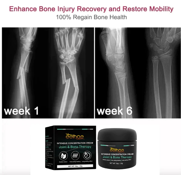 EELHOE™ Joint And Bone Therapy Cream
