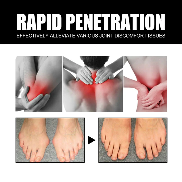 EELHOE™ Joint And Bone Therapy Cream