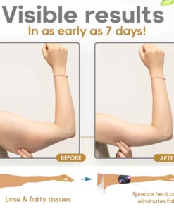 EXPECTSKY™ Ice Silk Ion Fiber Repair Arm Shaping Device