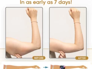 EXPECTSKY™ Ice Silk Ion Fiber Repair Arm Shaping Device