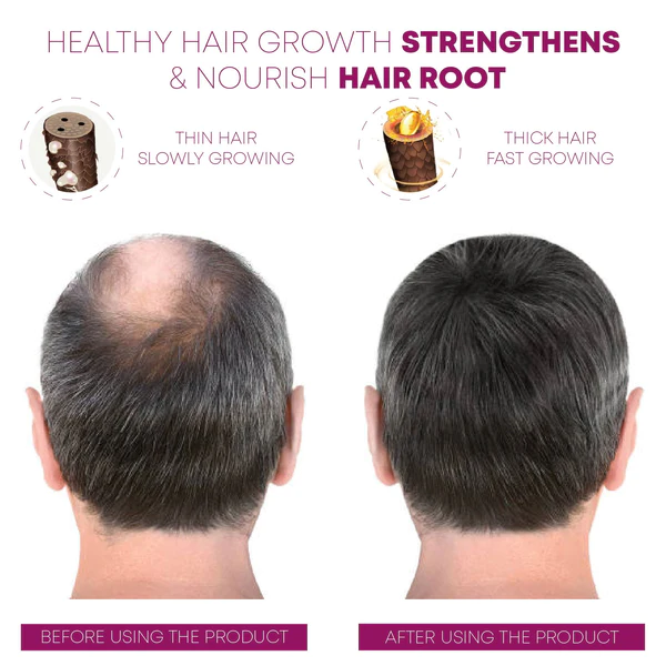 FOLIGAIN Men HairRegrowth EssenceSpray with Roller - Image 4