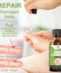 FOOTCARE™ Removal Paronychia Gel