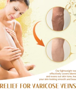 Fivfivgo™ Varicose Veins Miracle Cream