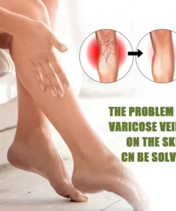 Fivfivgo™ Varicose Veins Spray