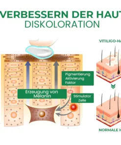 Fivfivgo™ VitiligoFix Revitalisierendes Elixier