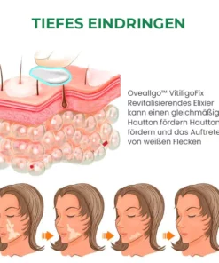 Fivfivgo™ VitiligoFix Revitalisierendes Elixier