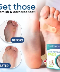 FootCare™ Corn Removal Pads (10 pcs)