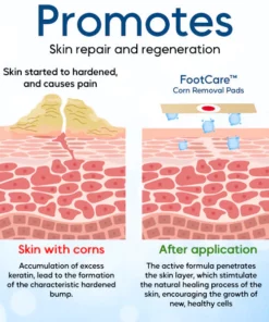 FootCare™ Corn Removal Pads (10 pcs)