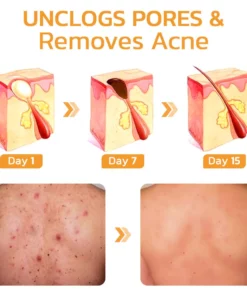 GFOUK™ FAFASKIN Back Spots And Acanthosis Nigricans Cleansing Lotion