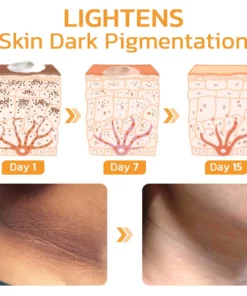 GFOUK™ FAFASKIN Back Spots And Acanthosis Nigricans Cleansing Lotion