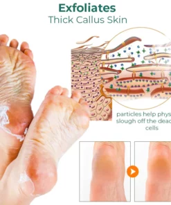 GFOUK™ Foot Callus Removal Spray