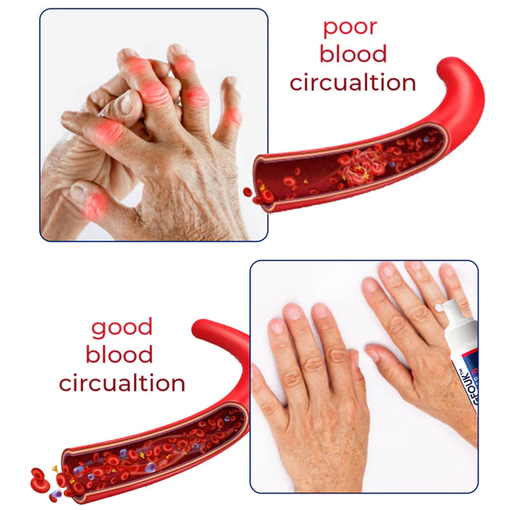 JointMax Discomfort and Inflammation Relief Foam - Image 4