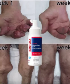 GFOUK™ JointMax Therapie- und Entzündungshemmendes Gel