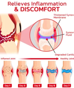 GFOUK™ JointMax Therapie- und Entzündungshemmendes Gel