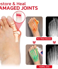 GFOUK™ JointMax Therapy and Inflammation Relief Gel