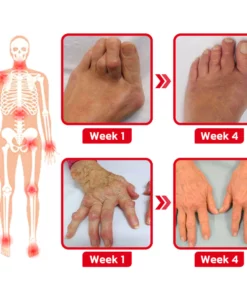 GFOUK™ JointMax Therapy and Inflammation Relief Gel