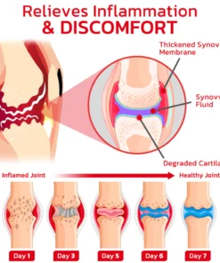 GFOUK™ JointMax Therapy and Inflammation Relief Gel
