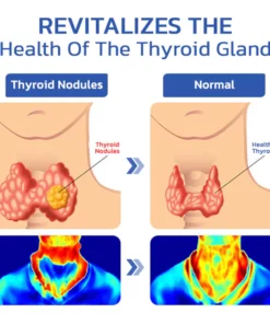 GFOUK™ ThyroidCare Anti-Schwellung Lymphatische Reinigungsrolle