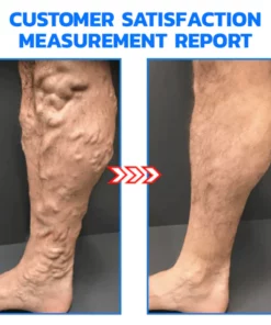 GFOUK™ Tourmaline Ionic Body Shaping Stretch Socks