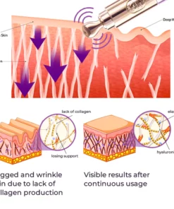 GFOUK™️ Milk Spots Therapy Electric Serum Pen