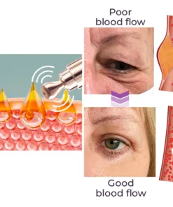 GFOUK™️ Milk Spots Therapy Electric Serum Pen