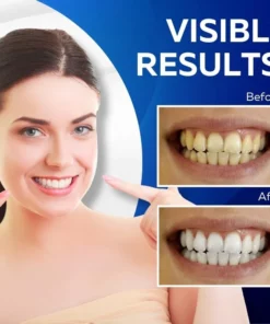 Gleam3D™ Teeth Whitening Strips
