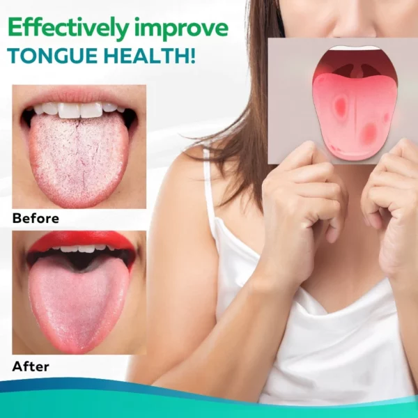 HealPlus™ 舌修復スプレー