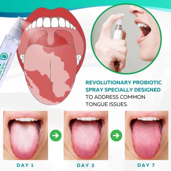 Spray pentru repararea limbii HealPlus™