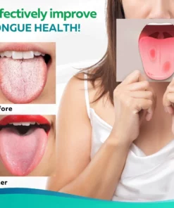 HealPlus™ Tongue Repair Spray