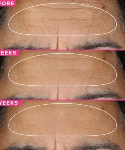 LéVire™ Retionl Anti-Aging Serum