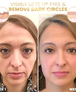 Liascy™ Le Lift ProxylanEssence Eye Cream