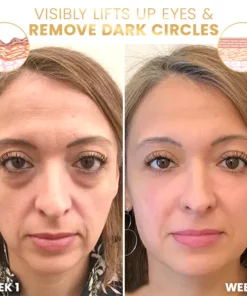 Liascy™ ProxylanEssence Eye Cream