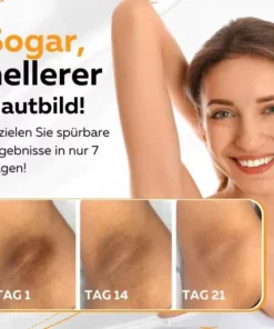 Luminovate™ Creme für dunkle Hautpartien