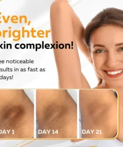 Luminovate™ Dark Skin Areas Cream