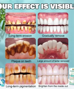 MIQIKO™ Leg & Joint Repair Spray