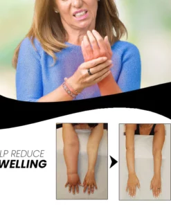 Magnetic Lymphatic Drainage Therapeutic Ring