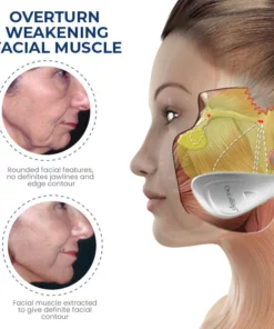 Oveallgo™ JawFit Pro Face Sculptor