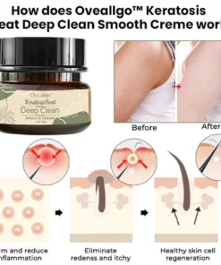 Oveallgo™ Keratosis Treat Deep Clean Smooth Creme