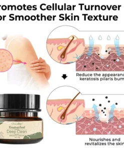 Oveallgo™ Keratosis Treat Deep Clean Smooth Creme