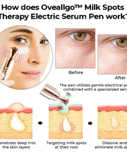 Oveallgo™ Milk Spots Therapy Electric Serum Pen