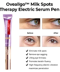Oveallgo™ Milk Spots Therapy Electric Serum Pen