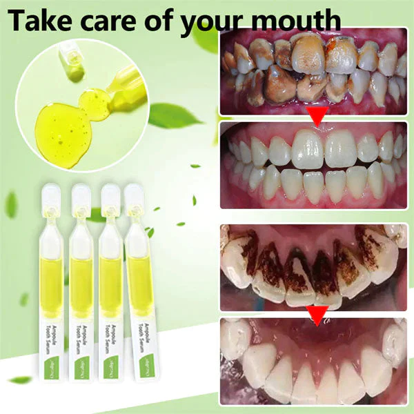 Oveallgo™ PRO Ampoule Tooth Serum